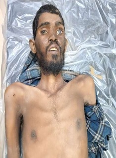 मानपाडा पोलीसांकडून अनोळखी मयताची ओळख पटविण्याचे आवाहन